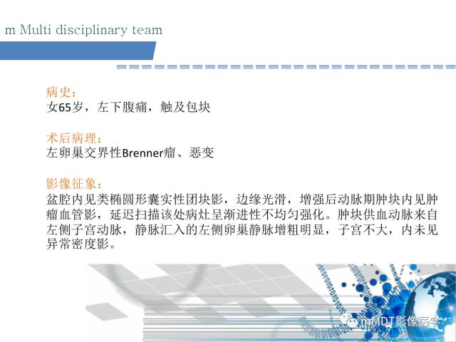 【PPT】卵巢Brenner瘤影像诊断