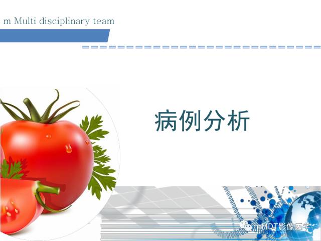 【PPT】卵巢Brenner瘤影像诊断