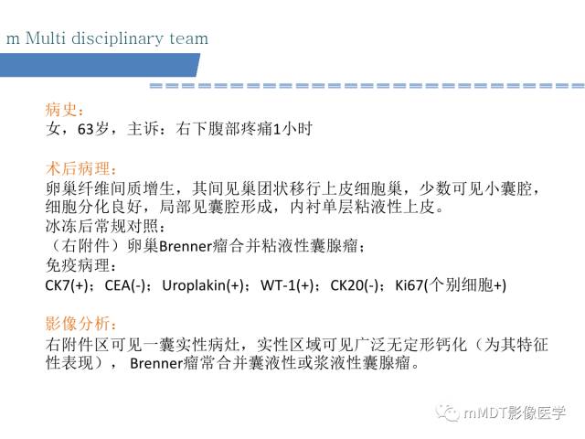 【PPT】卵巢Brenner瘤影像诊断
