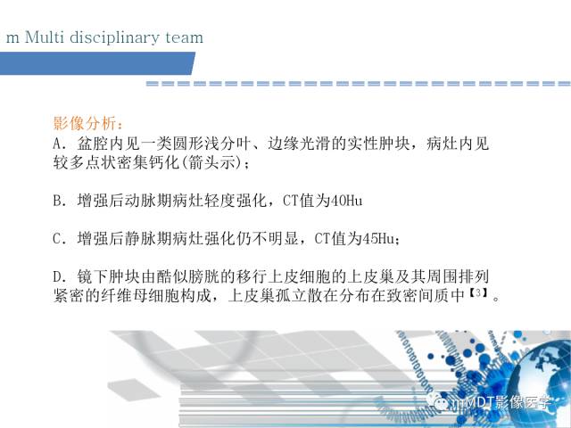 【PPT】卵巢Brenner瘤影像诊断