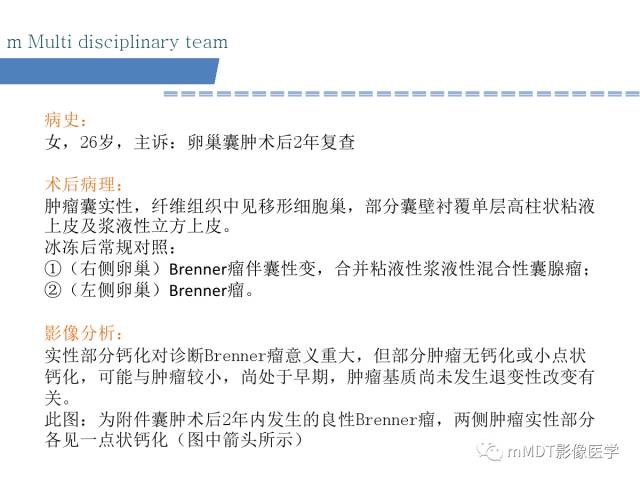 【PPT】卵巢Brenner瘤影像诊断