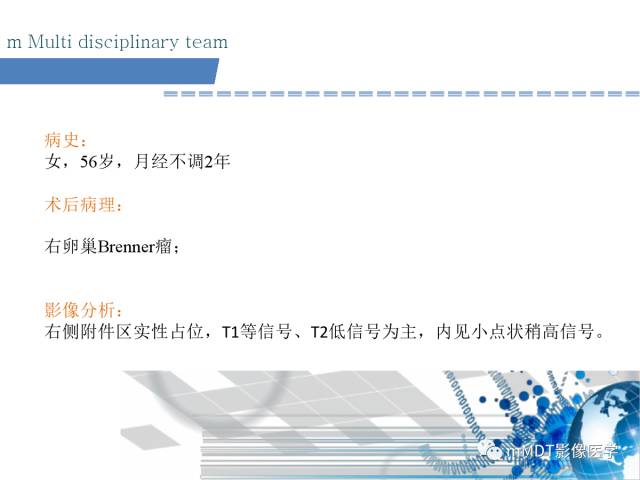 【PPT】卵巢Brenner瘤影像诊断
