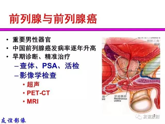 【PPT】前列腺的多参数MRI检查与病变的PI-RADS分类