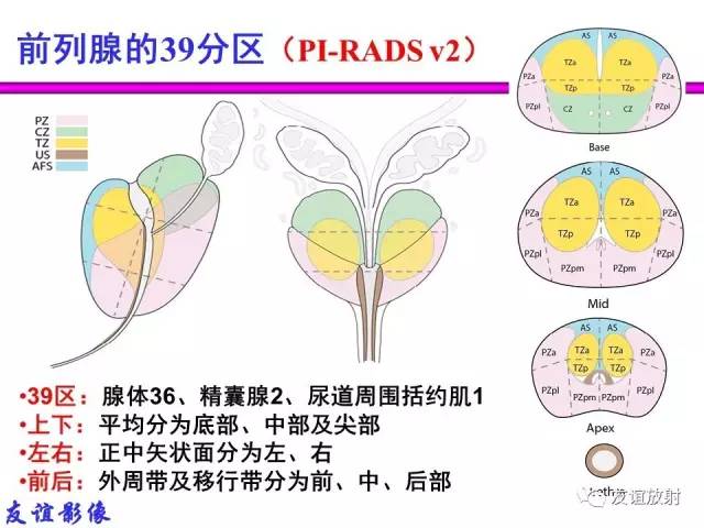 【PPT】前列腺的多参数MRI检查与病变的PI-RADS分类