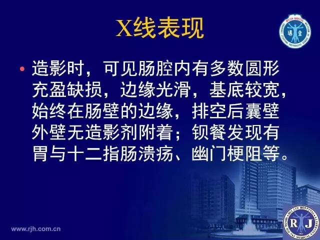 【PPT】反射性肠郁积的影像学表现