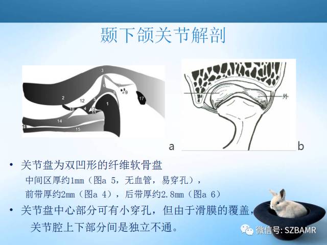 【PPT】颞下颌关节解剖及关节紊乱影像表现