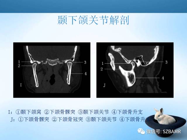 【PPT】颞下颌关节解剖及关节紊乱影像表现