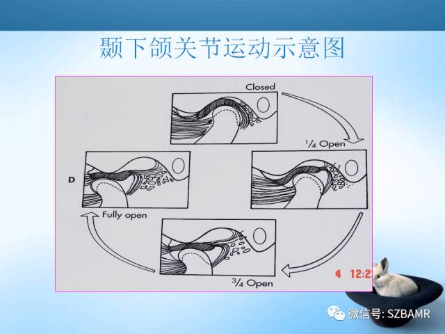 【PPT】颞下颌关节解剖及关节紊乱影像表现