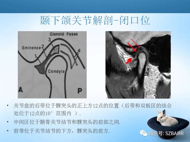 【PPT】颞下颌关节解剖及关节紊乱影像表现