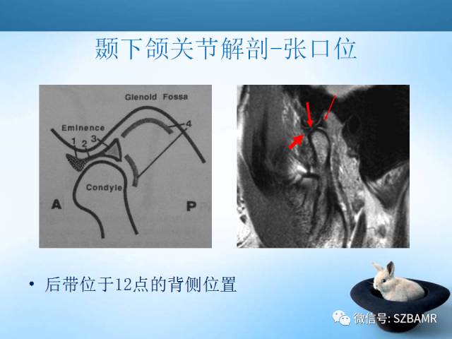 【PPT】颞下颌关节解剖及关节紊乱影像表现