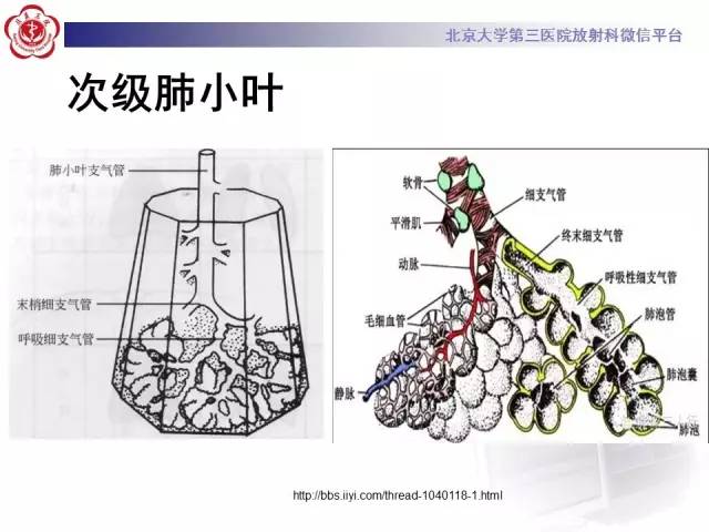 【PPT】磨玻璃密度病变的CT诊断（一）
