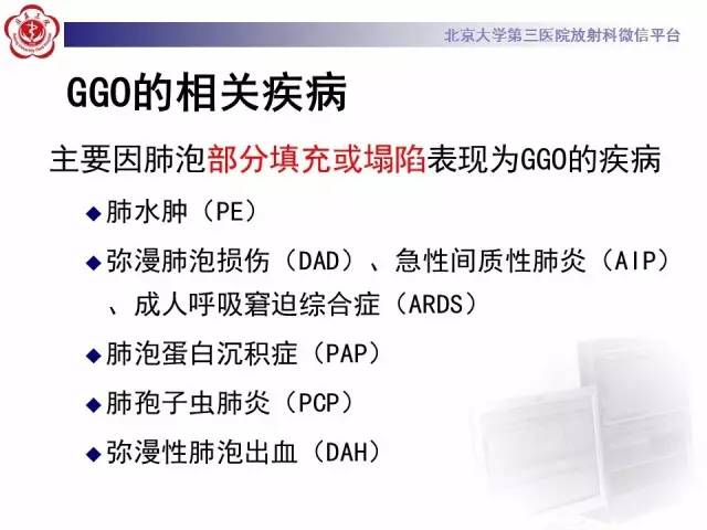 【PPT】磨玻璃密度病变的CT诊断（一）
