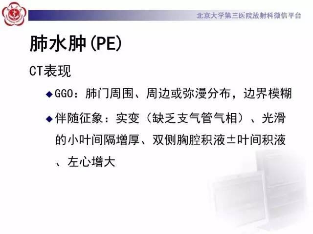 【PPT】磨玻璃密度病变的CT诊断（一）