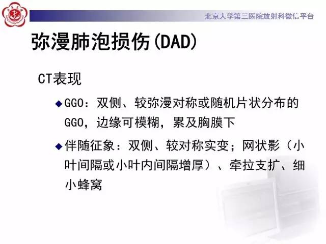 【PPT】磨玻璃密度病变的CT诊断（一）