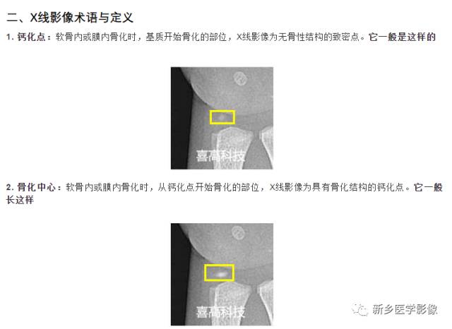 骨龄读片基础