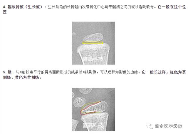 骨龄读片基础