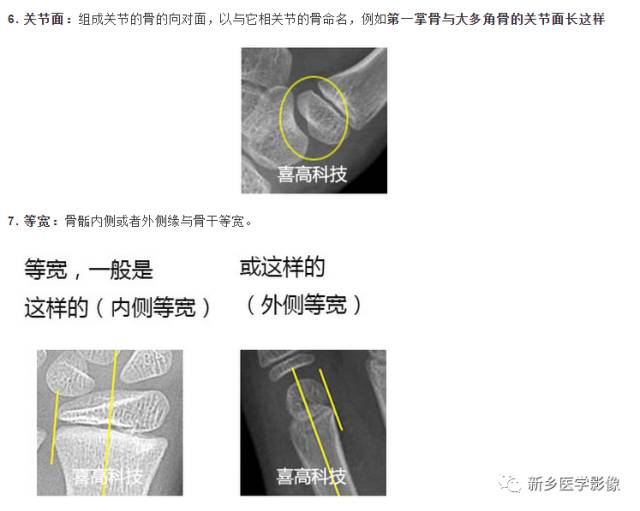 骨龄读片基础