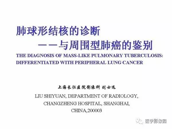 【PPT】肺球形结核的诊断——与周围型肺癌的鉴别