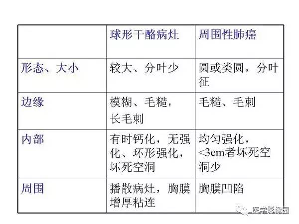 【PPT】肺球形结核的诊断——与周围型肺癌的鉴别