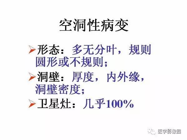 【PPT】肺球形结核的诊断——与周围型肺癌的鉴别