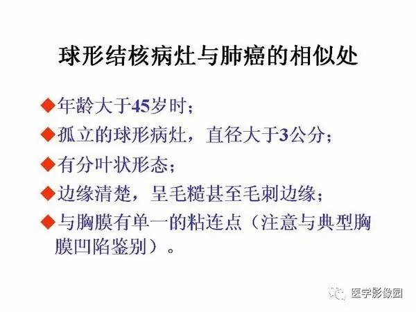 【PPT】肺球形结核的诊断——与周围型肺癌的鉴别