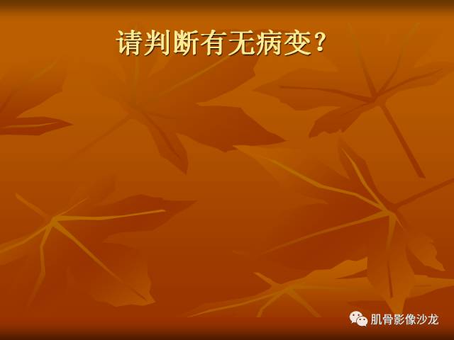 【病例】两例X线阴性的股骨干骺端占位性病变X线MR 【病例】两例X线阴性的股骨干骺端占位性病变X线MR