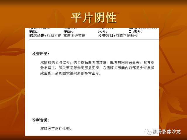 【病例】两例X线阴性的股骨干骺端占位性病变X线MR 【病例】两例X线阴性的股骨干骺端占位性病变X线MR