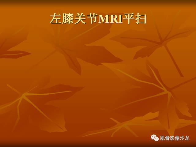 【病例】两例X线阴性的股骨干骺端占位性病变X线MR 【病例】两例X线阴性的股骨干骺端占位性病变X线MR