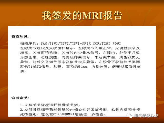 【病例】两例X线阴性的股骨干骺端占位性病变X线MR 【病例】两例X线阴性的股骨干骺端占位性病变X线MR
