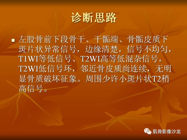 【病例】两例X线阴性的股骨干骺端占位性病变X线MR 【病例】两例X线阴性的股骨干骺端占位性病变X线MR