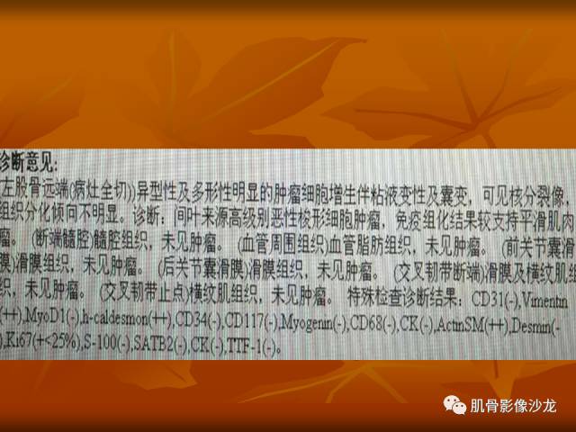 【病例】两例X线阴性的股骨干骺端占位性病变X线MR 【病例】两例X线阴性的股骨干骺端占位性病变X线MR