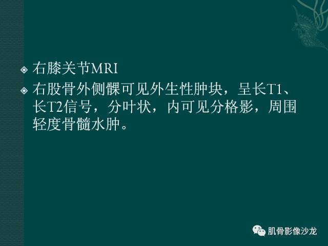 【病例】两例X线阴性的股骨干骺端占位性病变X线MR 【病例】两例X线阴性的股骨干骺端占位性病变X线MR