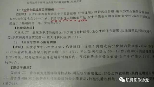 【病例】两例X线阴性的股骨干骺端占位性病变X线MR 【病例】两例X线阴性的股骨干骺端占位性病变X线MR