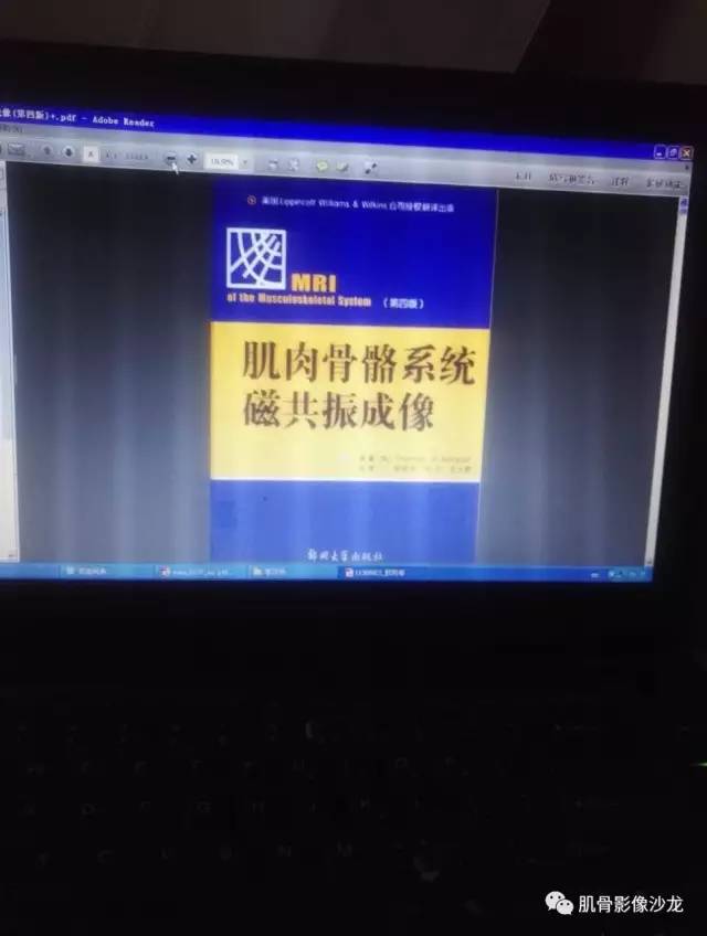 【病例】两例X线阴性的股骨干骺端占位性病变X线MR 【病例】两例X线阴性的股骨干骺端占位性病变X线MR