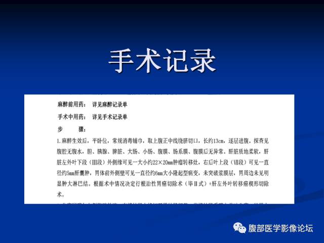 【病例】胃神经内分泌瘤伴肝转移1例MR 【病例】胃神经内分泌瘤伴肝转移1例MR
