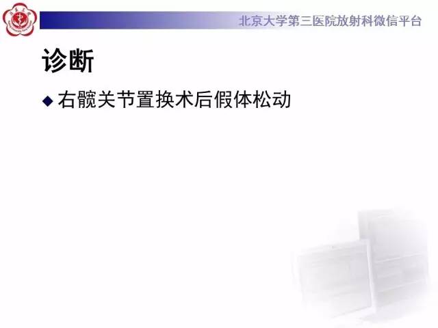 【病例】髋关节置换术后假体松动2例X线