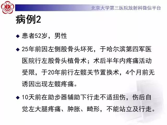 【病例】髋关节置换术后假体松动2例X线