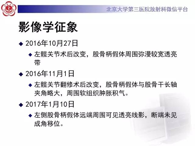 【病例】髋关节置换术后假体松动2例X线