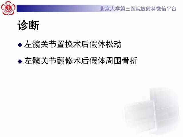 【病例】髋关节置换术后假体松动2例X线