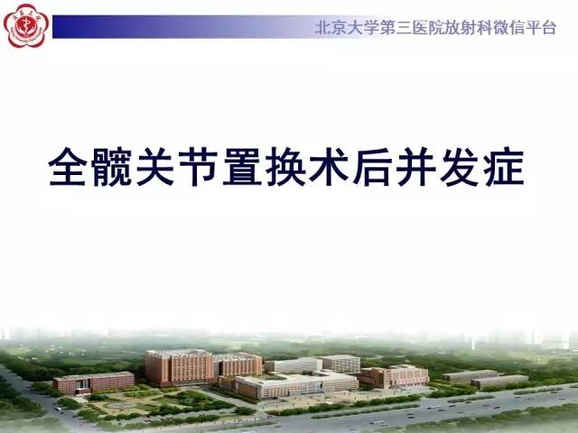 【病例】髋关节置换术后假体松动2例X线