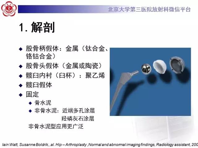 【病例】髋关节置换术后假体松动2例X线