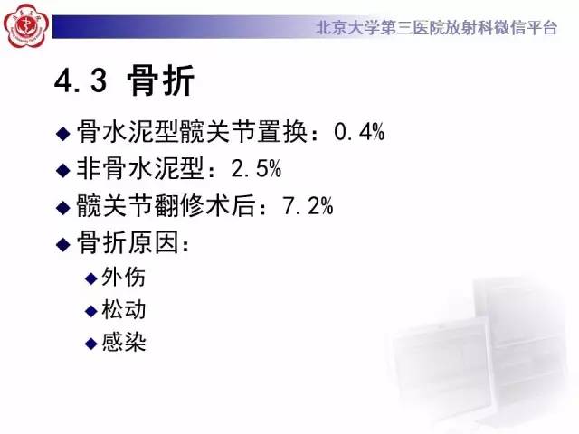 【病例】髋关节置换术后假体松动2例X线