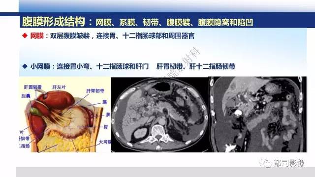 【PPT】腹膜解剖及炎性病变影像诊断