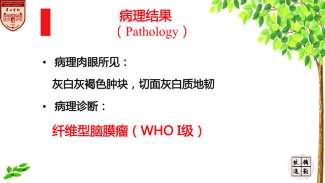 【病例】脑室内脑膜瘤1例MR影像表现 【病例】脑室内脑膜瘤1例MR影像表现