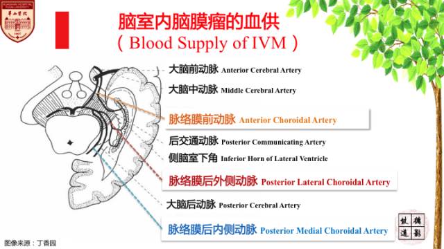 【病例】脑室内脑膜瘤1例MR影像表现 【病例】脑室内脑膜瘤1例MR影像表现