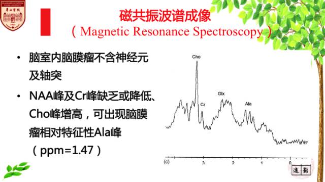【病例】脑室内脑膜瘤1例MR影像表现 【病例】脑室内脑膜瘤1例MR影像表现