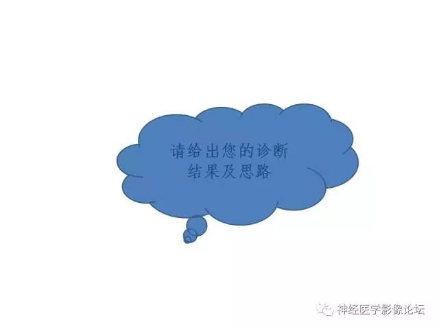 【病例】伴有脑膜尾征的3例颅内肿瘤影像鉴别讨论