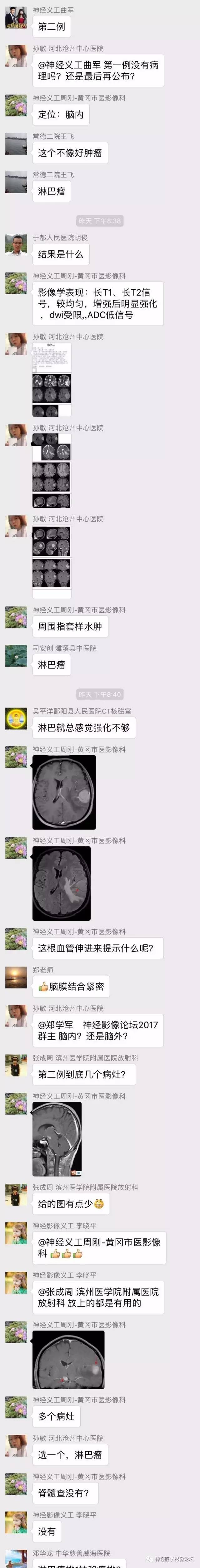 【病例】伴有脑膜尾征的3例颅内肿瘤影像鉴别讨论