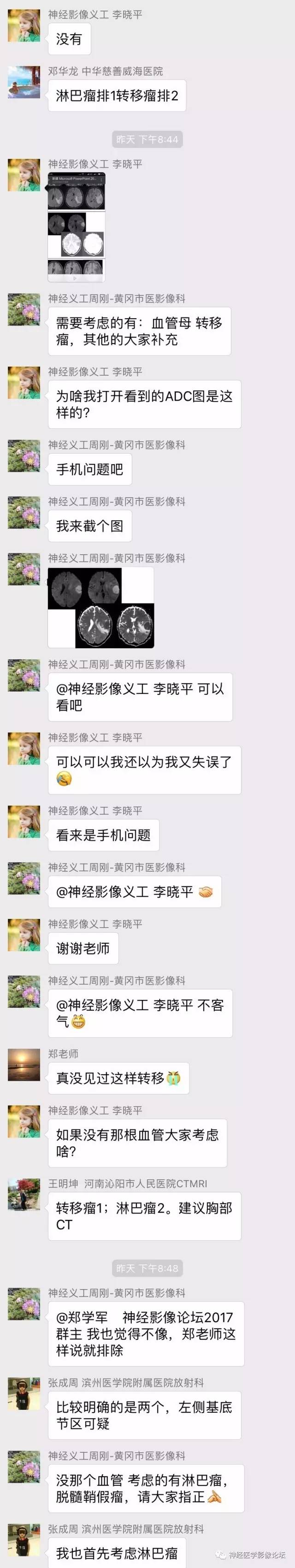 【病例】伴有脑膜尾征的3例颅内肿瘤影像鉴别讨论