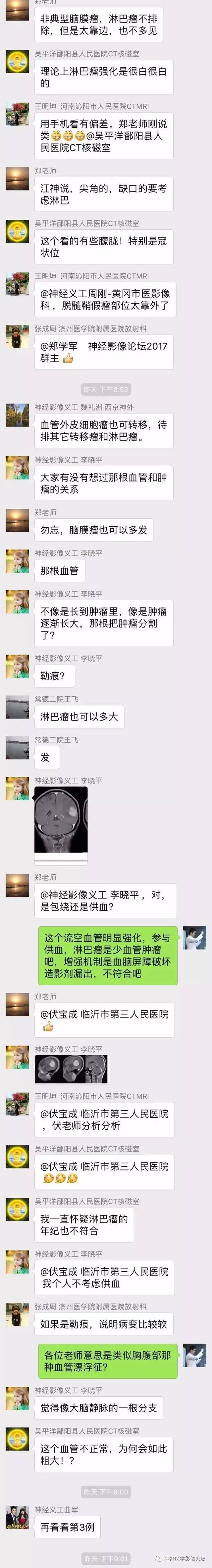 【病例】伴有脑膜尾征的3例颅内肿瘤影像鉴别讨论